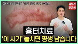유튜브썸네일