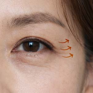 눈 주변 탄력 및 피부결 개선