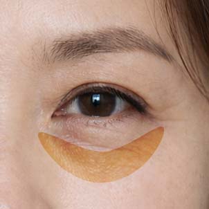 눈 밑 울퉁불퉁한 피부 정돈