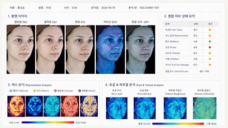 피부 데이터 리포트 제공